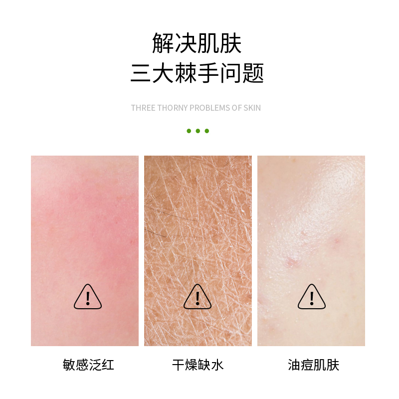 careV珂尔维舒缓补水修护套装（三合一）